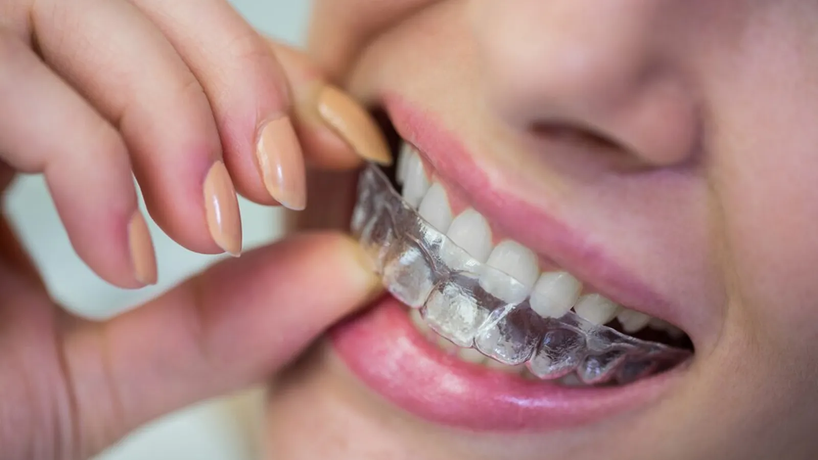 Patient in dental chair during teeth extraction consultation