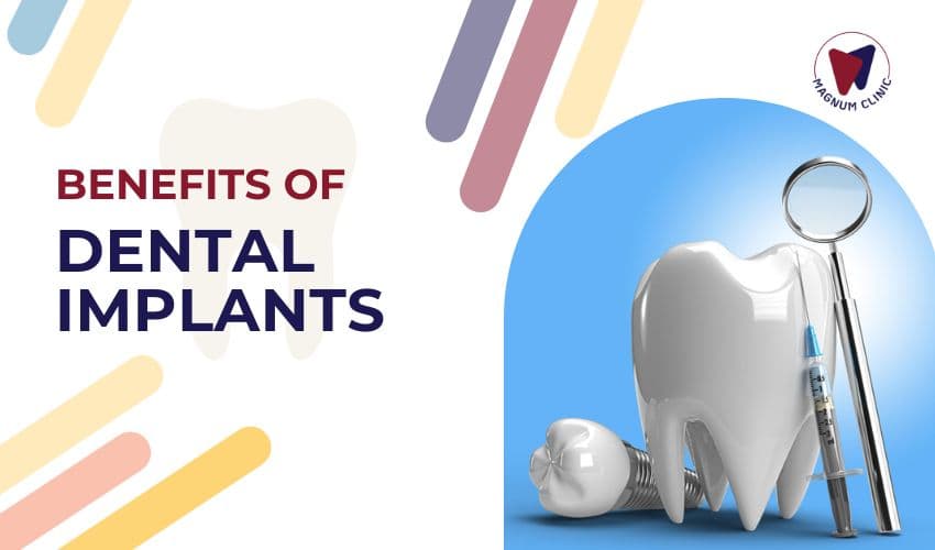 Benefits Of Dental Implants: Why They May Be The Best Option