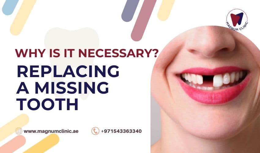 5 Reasons Why Replacing a Missing Tooth is Necessary to Improve your Oral Health