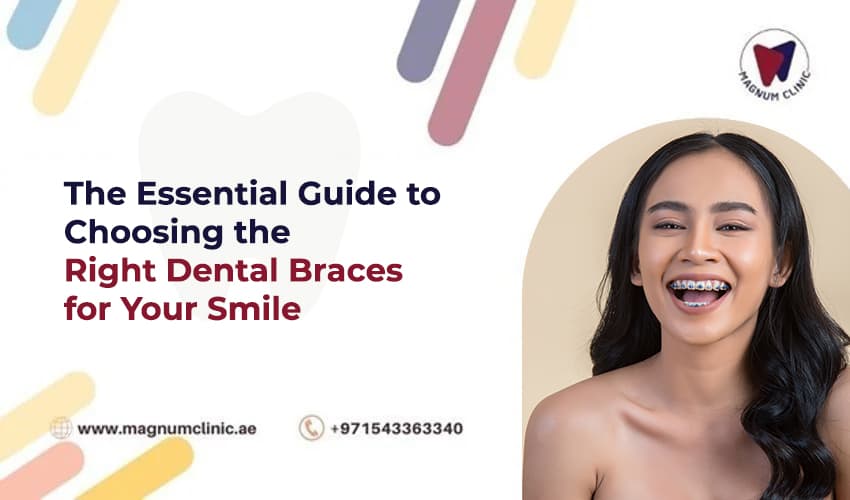 The Essential Guide to Choosing the Right Dental Braces for Your Smile