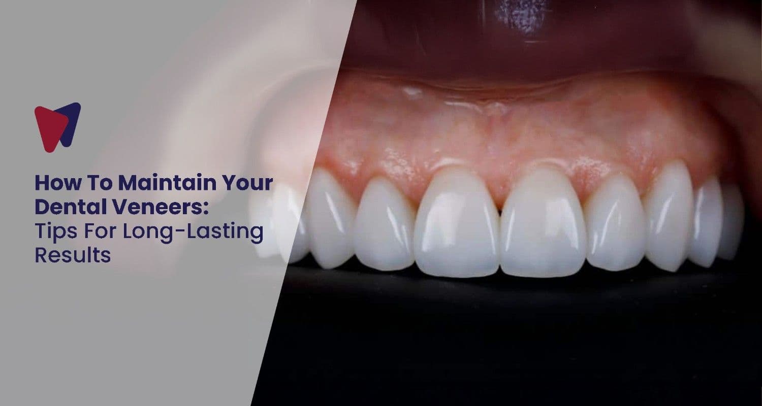 The Best Ways To Maintain Your Dental Veneers
