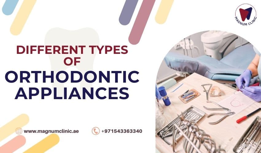 Understanding Different Types of Orthodontic Appliances: Braces, Aligners, and More