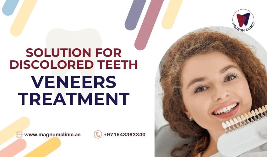 Are Veneers A Permanent Solution For Discolored Teeth