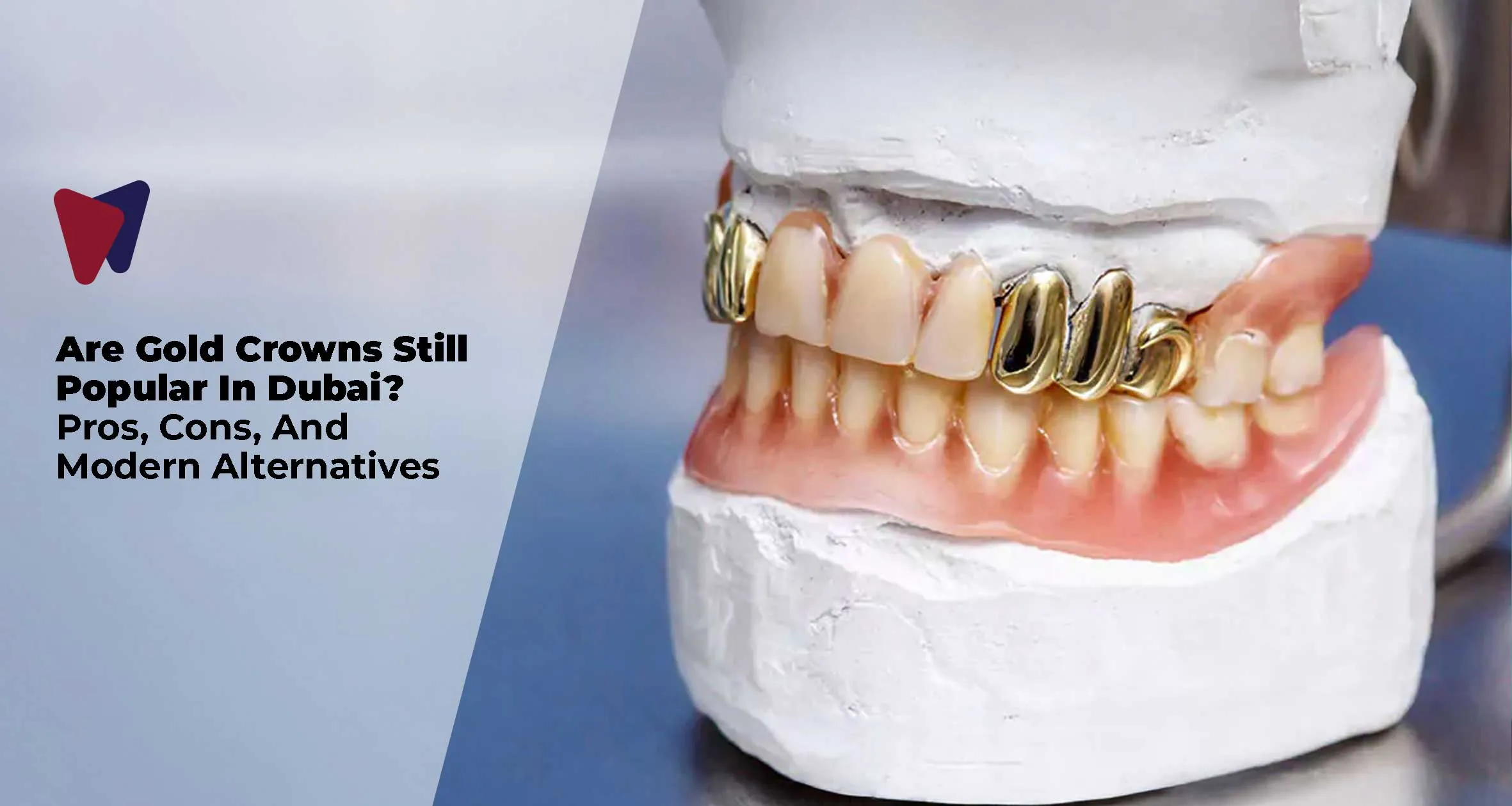 Are Gold Crowns Still Popular In Dubai? Pros, Cons, And Modern Alternatives