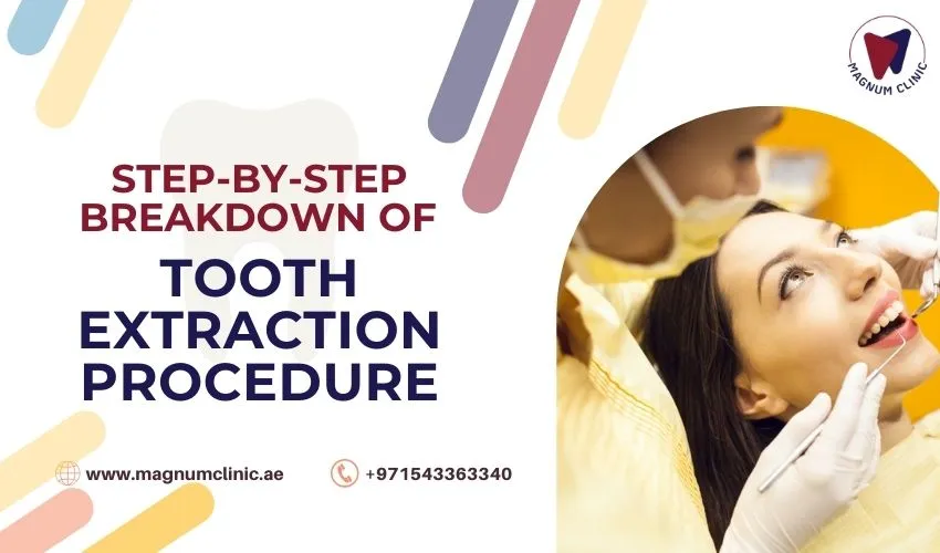 Step-By-Step Breakdown of A Tooth Extraction Procedure