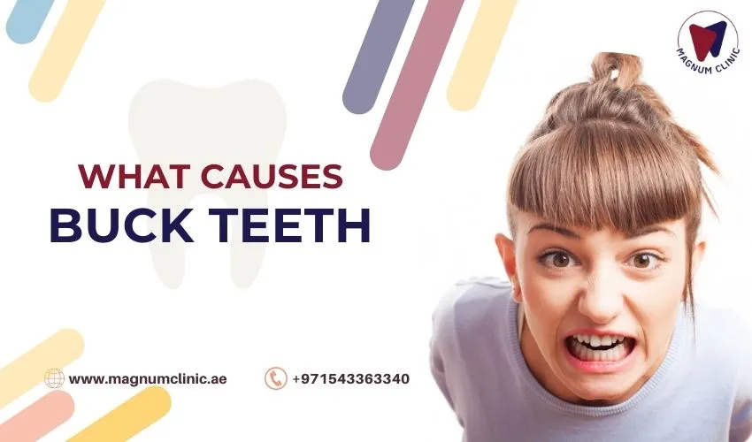 What causes buck teeth? buck teeth treatment