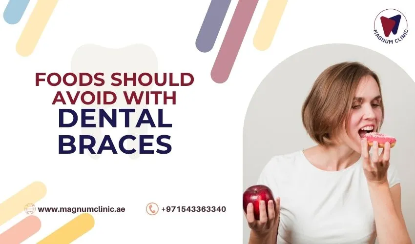 What Foods Should You Avoid with Dental Braces? Orthodontic Diet Tips