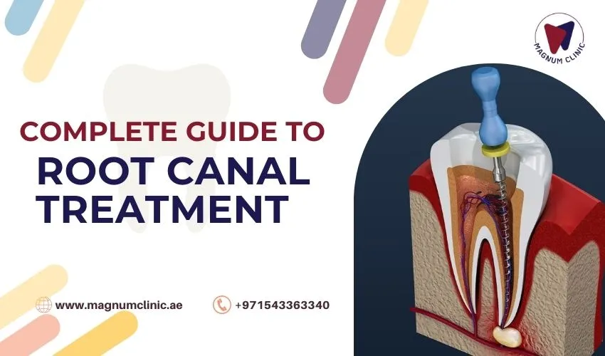 The Complete Guide to Root Canal Treatment: Procedure, Benefits and Aftercare