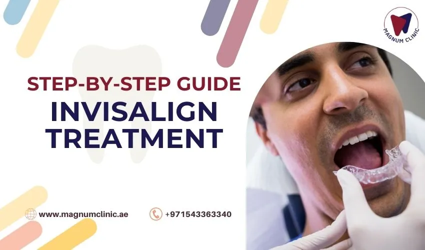 The Step-by-Step Guide to Invisalign Treatment Process