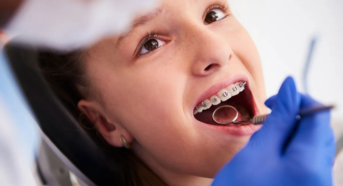 Orthodontic Treatment for Children: Pros and Cons