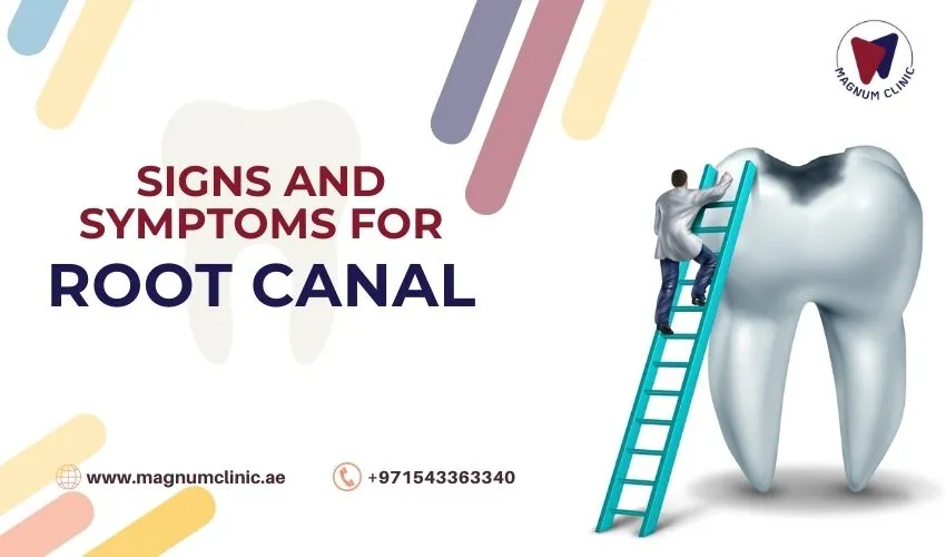 Signs and Symptoms That Indicate You Might Need a Root Canal
