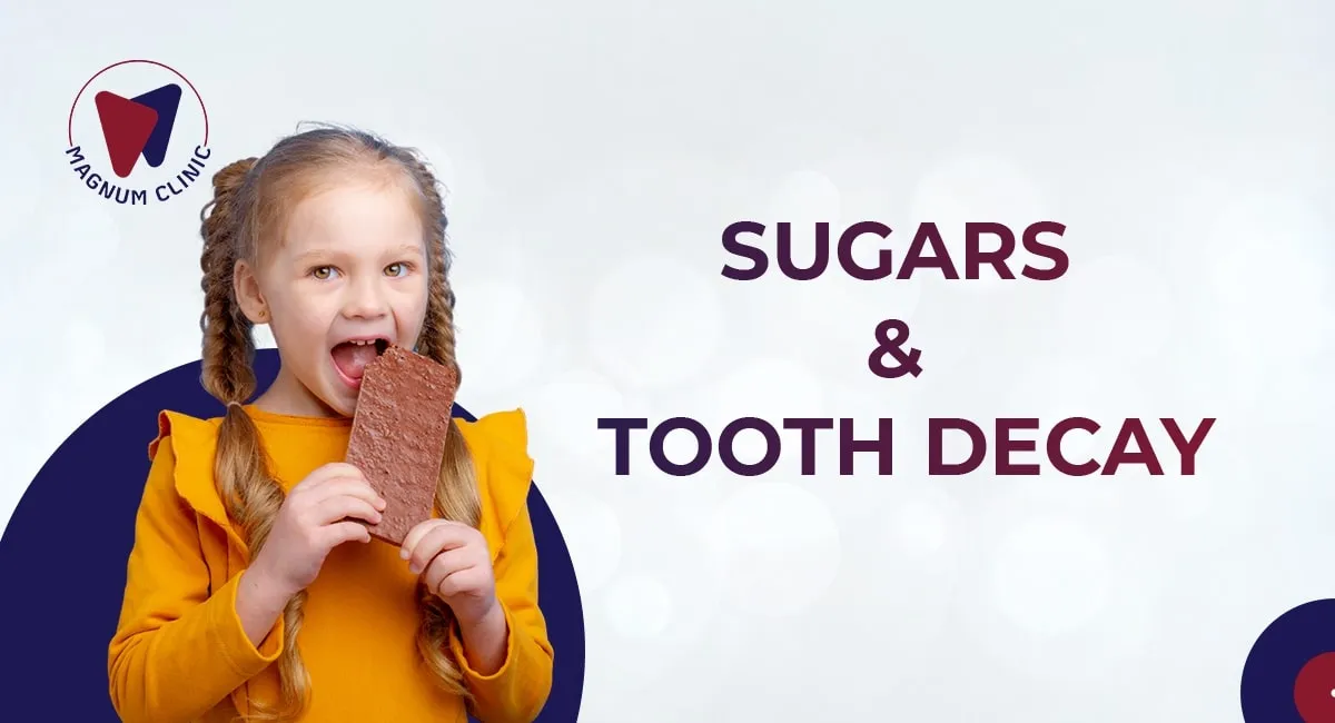 How Sugar Causes Tooth Cavities and What You Can Do to Prevent Them?