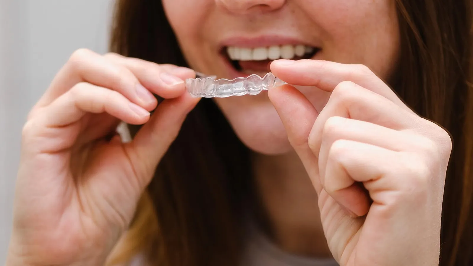 Patient in dental chair during teeth extraction consultation