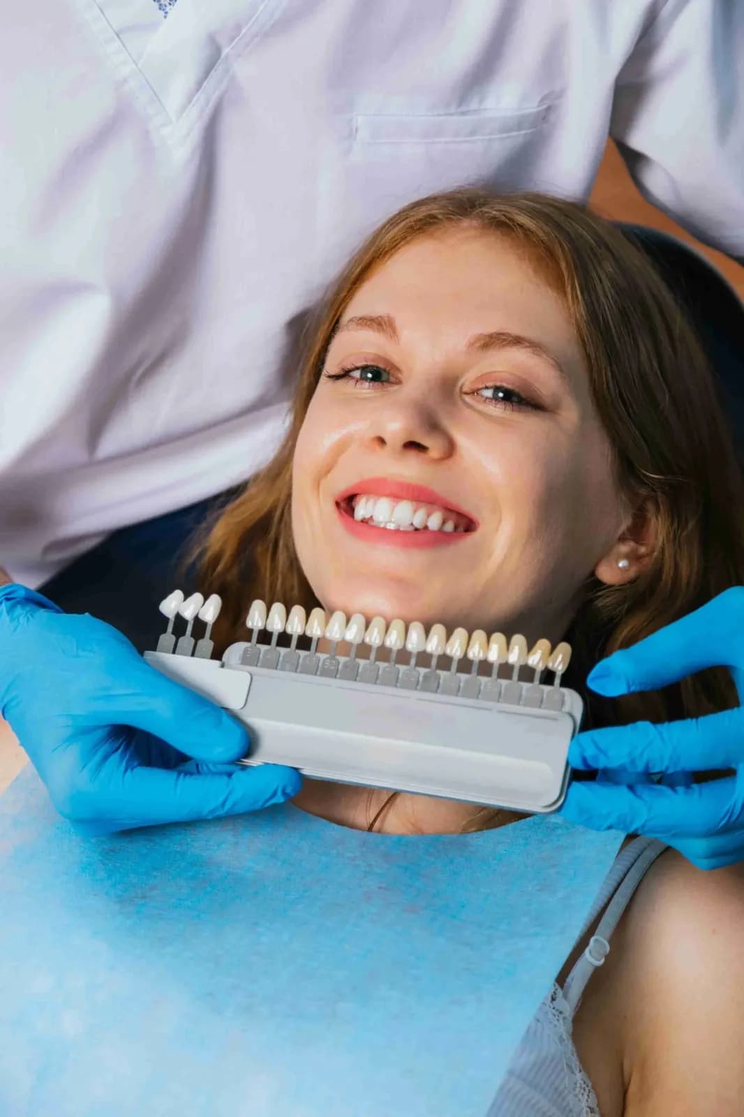 Benefits of Composite Veneers Dubai
