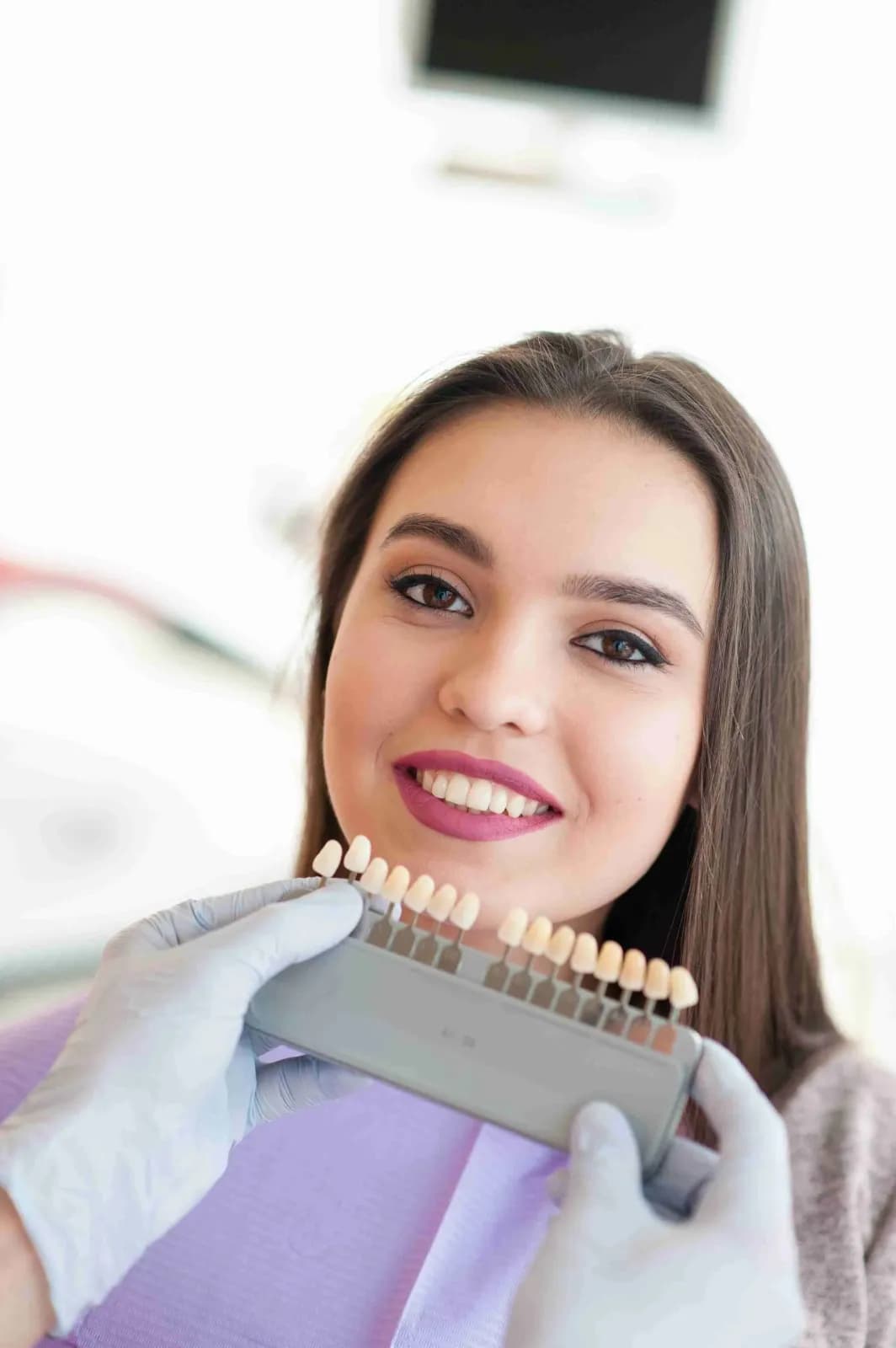 Composite Veneers Dubai Cost