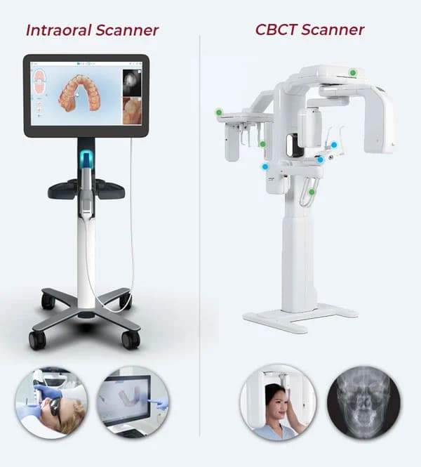 Advanced dental technology featuring an Intraoral Scanner and a CBCT Scanner for precise diagnostics and treatment planning.