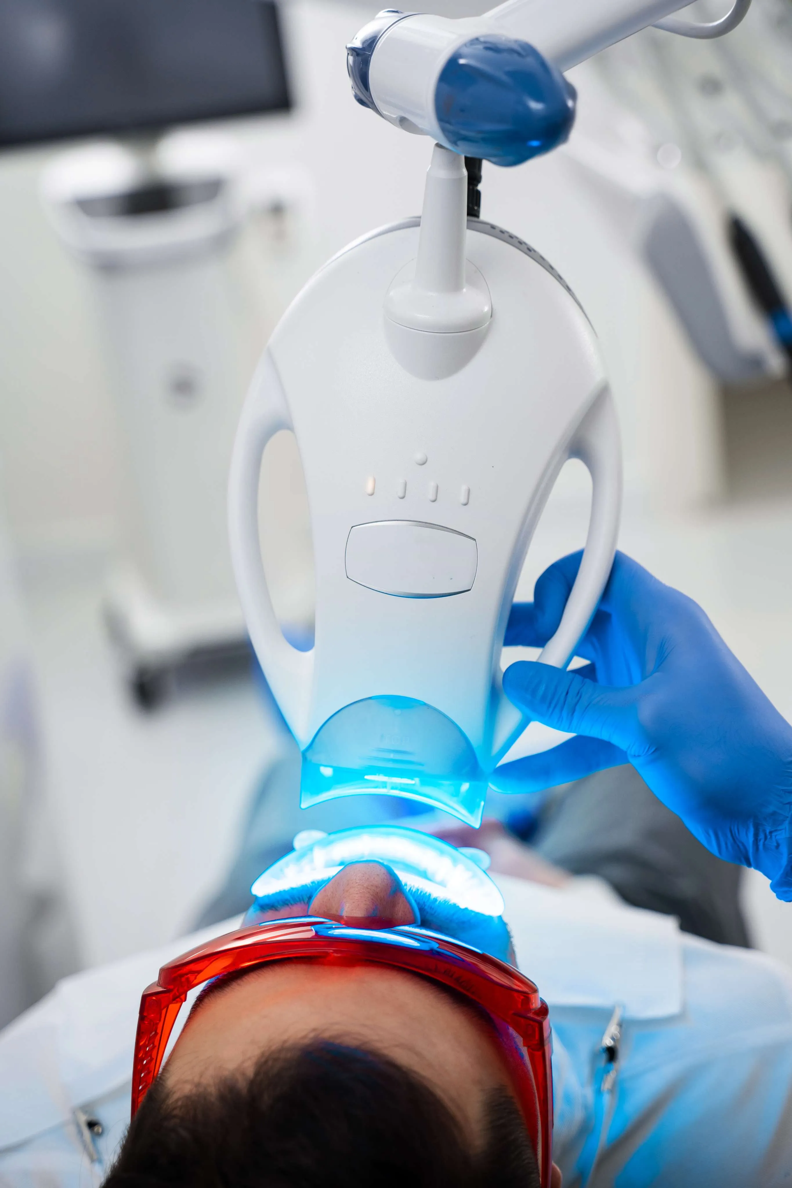 Whitening results with Philips Zoom