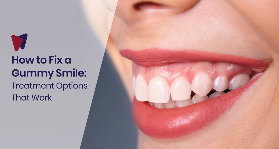 How To Fix A Gummy Smile: Treatment Options That Work