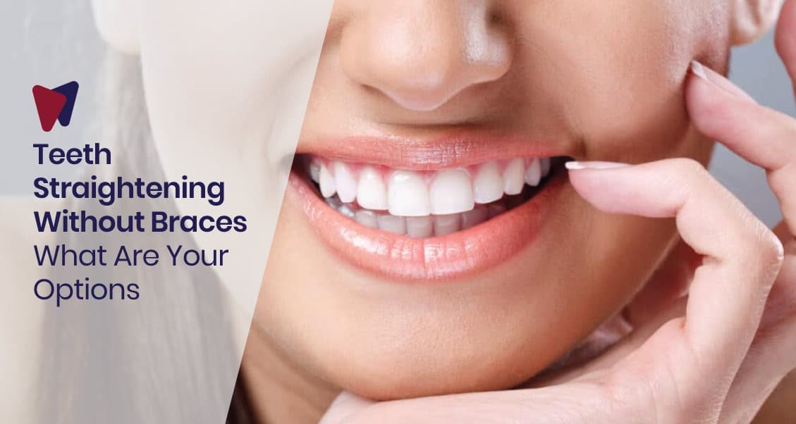 Teeth Straightening Without Braces: What Are Your Options?