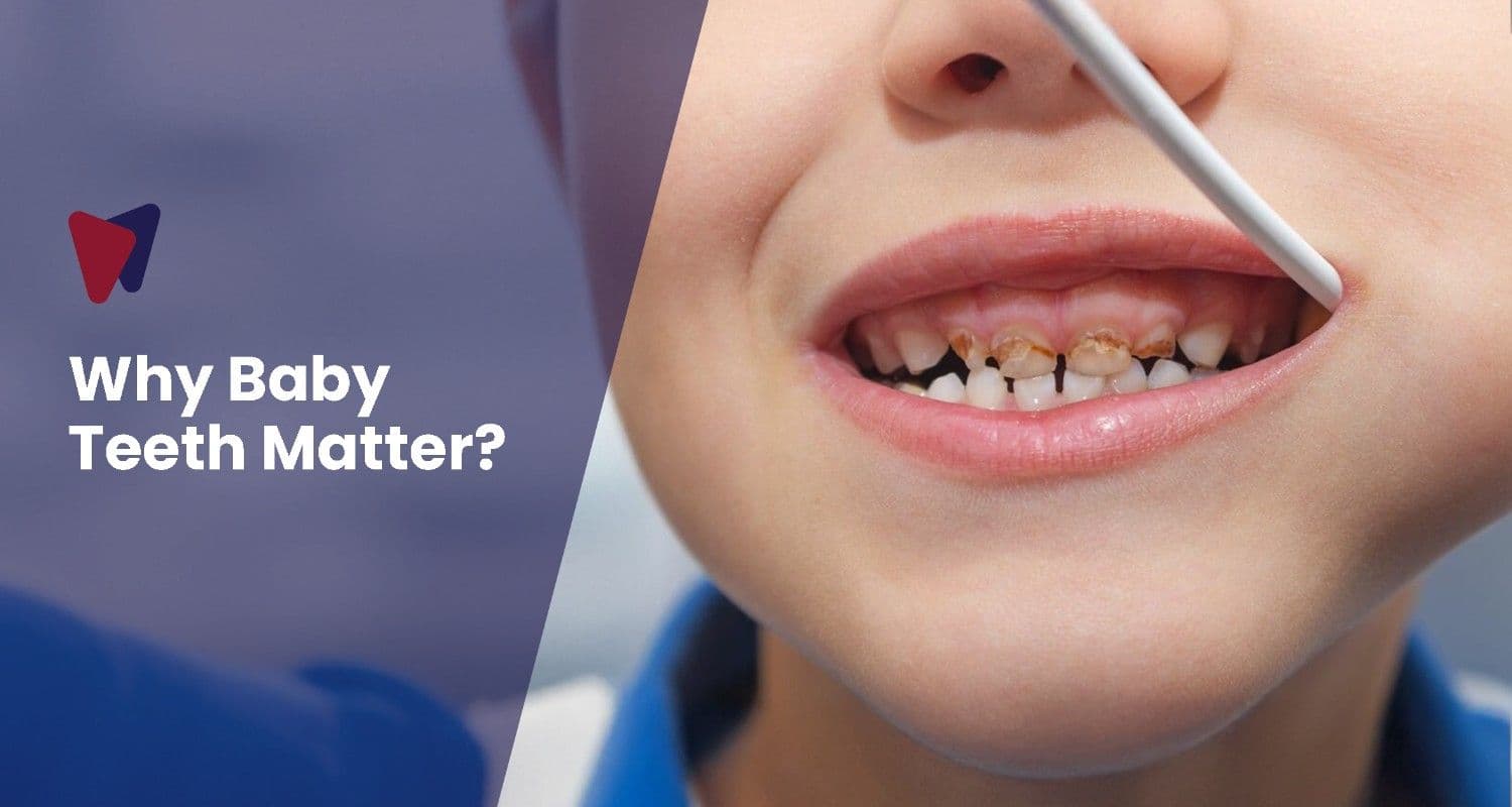 Why Baby Teeth Matter: The Truth About Early Childhood Dental Care