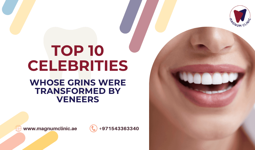 TOP 10 Celebrities Whose Grins Were Transformed by Veneers