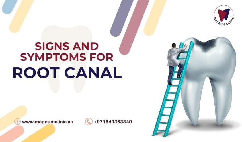 Signs and Symptoms That Indicate You Might Need a Root Canal