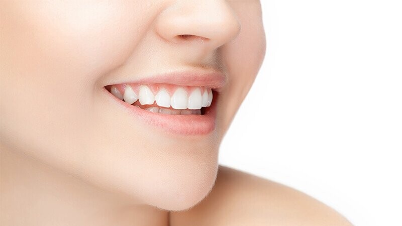 teeth whitening treatment