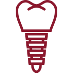 dental implants near me