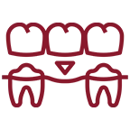 dental bridges cost