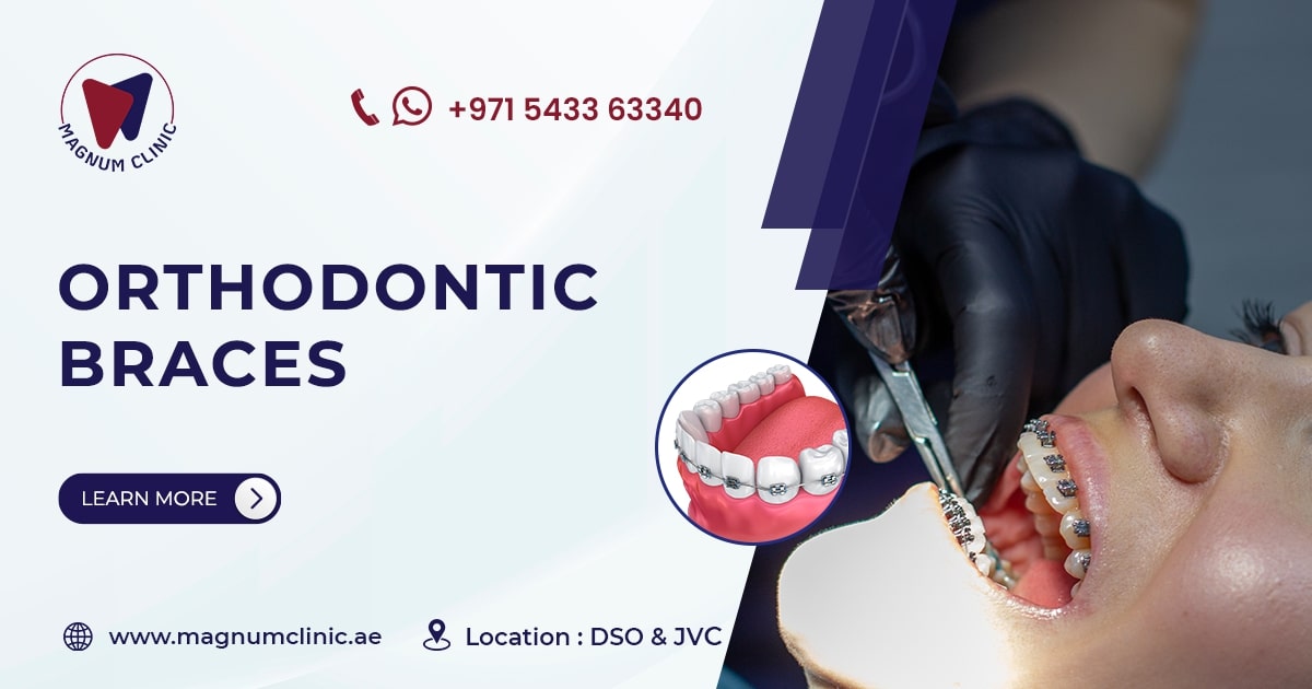 Teeth Aligners in Dubai Clear Aligners Price Magnum Clinic