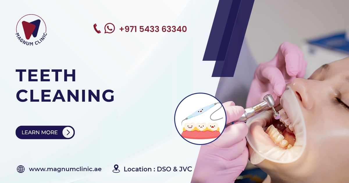 Teeth Cleaning & Polishing in Dubai Magnum Clinic