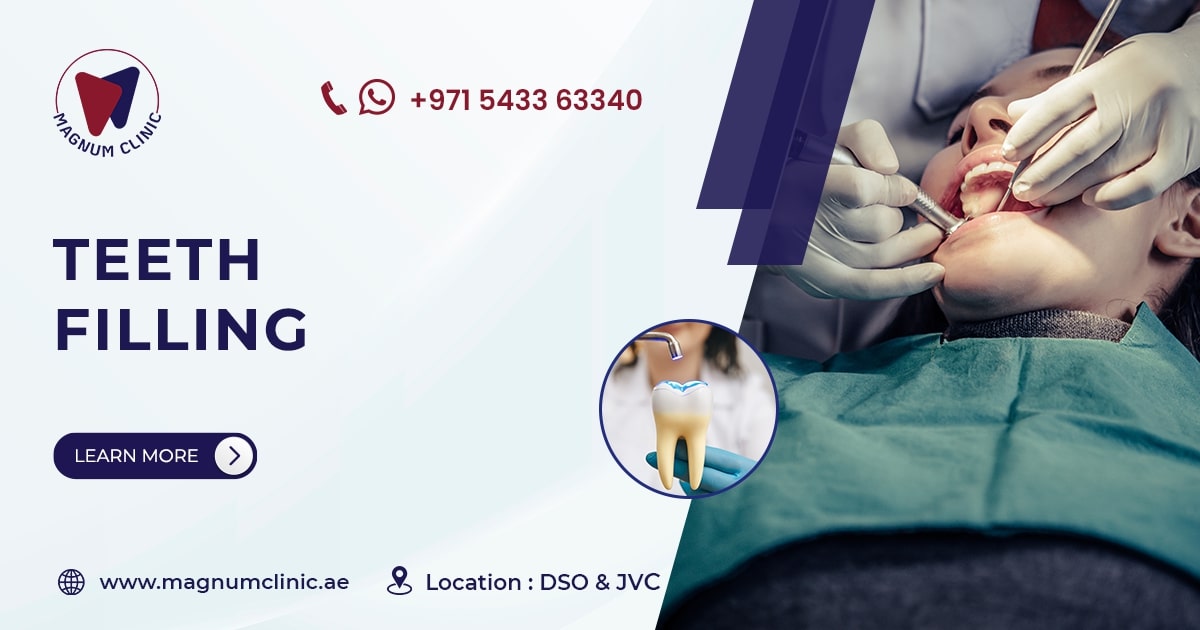 Dental Filling in Dubai - Tooth Filling Price - Magnum Clinic Dental Filling in Dubai - Tooth Filling Price - Magnum Clinic