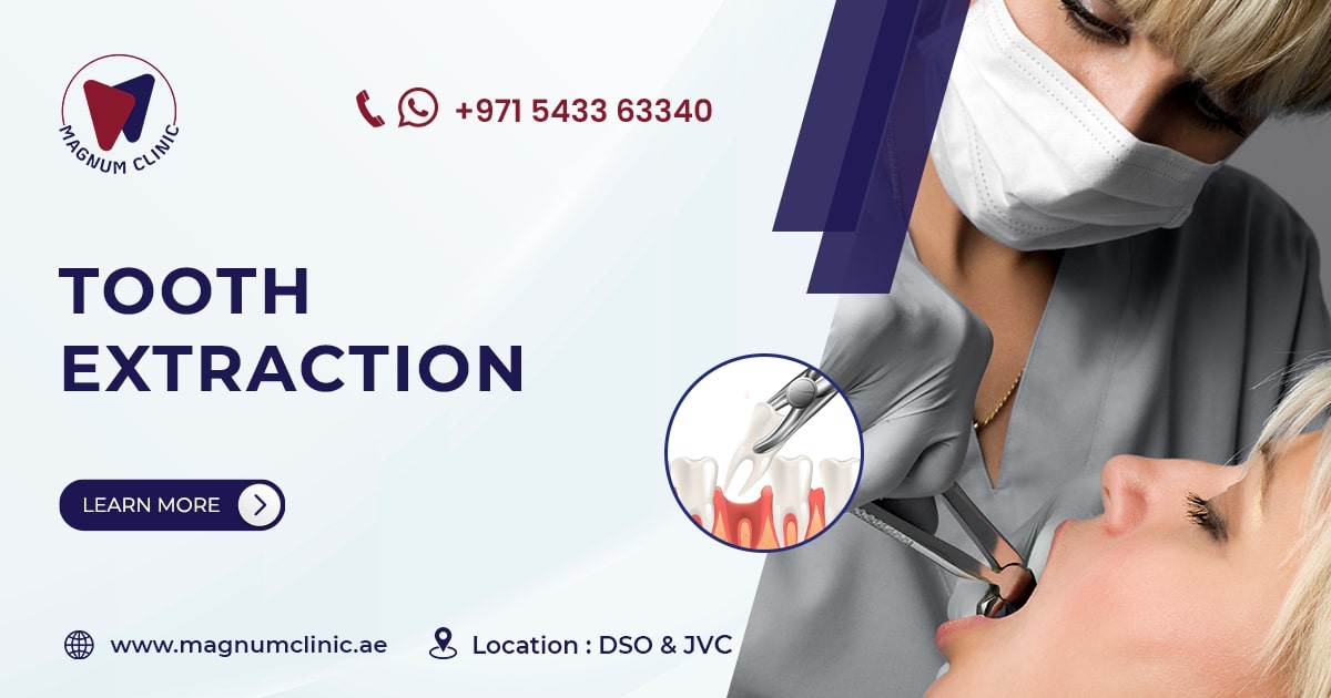 Teeth Extraction/Removal in Dubai Tooth Extraction Price Magnum Clinic