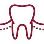 dental cervical abrasion