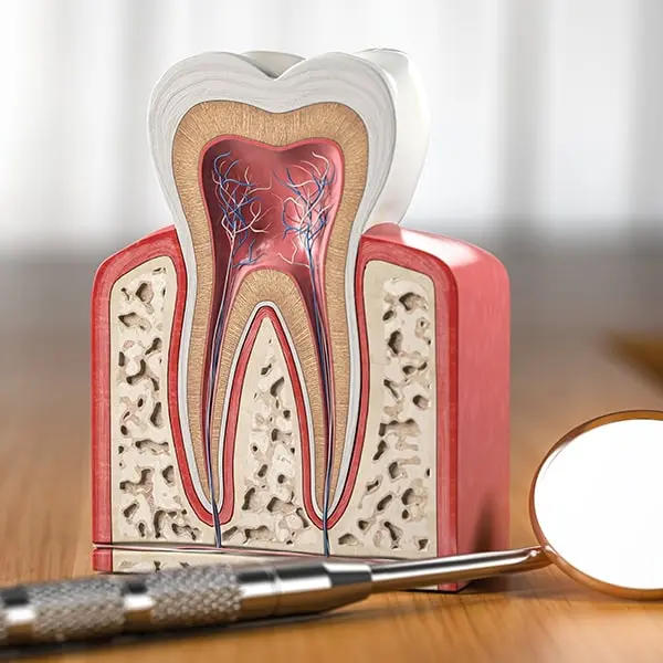 Re_Root_Canal_Image