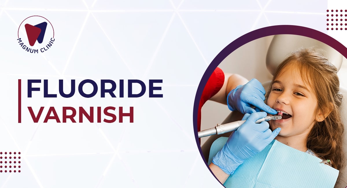 Fluoride Varnish Dental Treatment