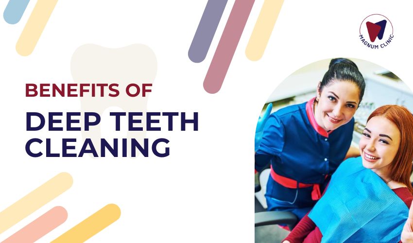 Benefits Of Deep Teeth Cleaning