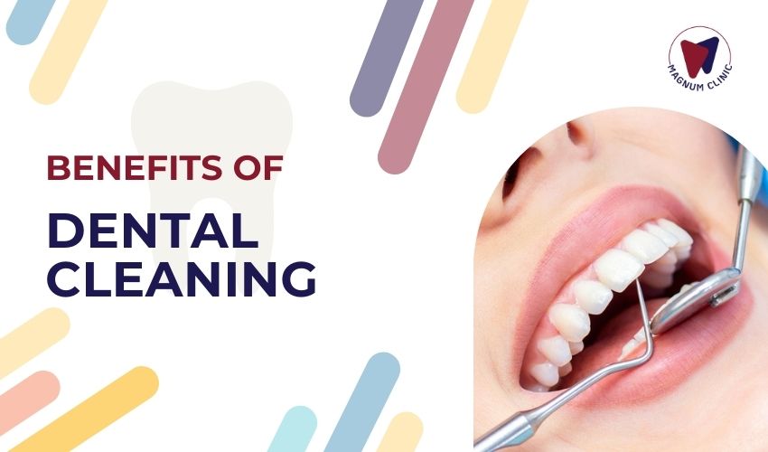 Benefits of Regular Dental Cleaning