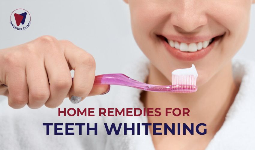 Home Remedies for Teeth Whitening