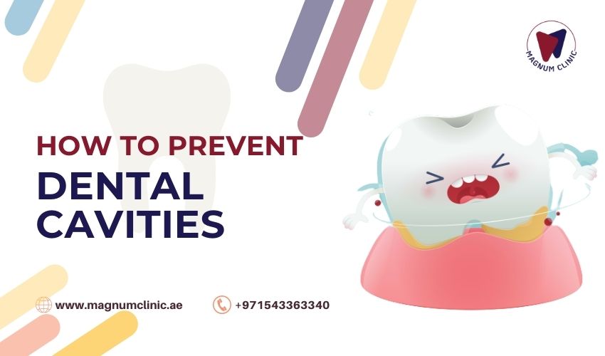 How to prevent dental cavities