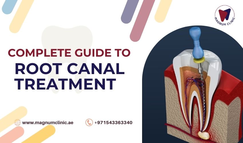 Root Canal Treatment