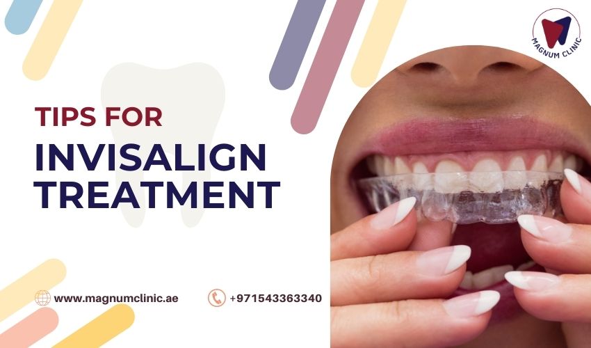 Tips For Invisalign Treatment