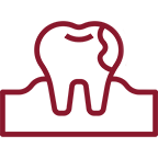 tooth decay treatment