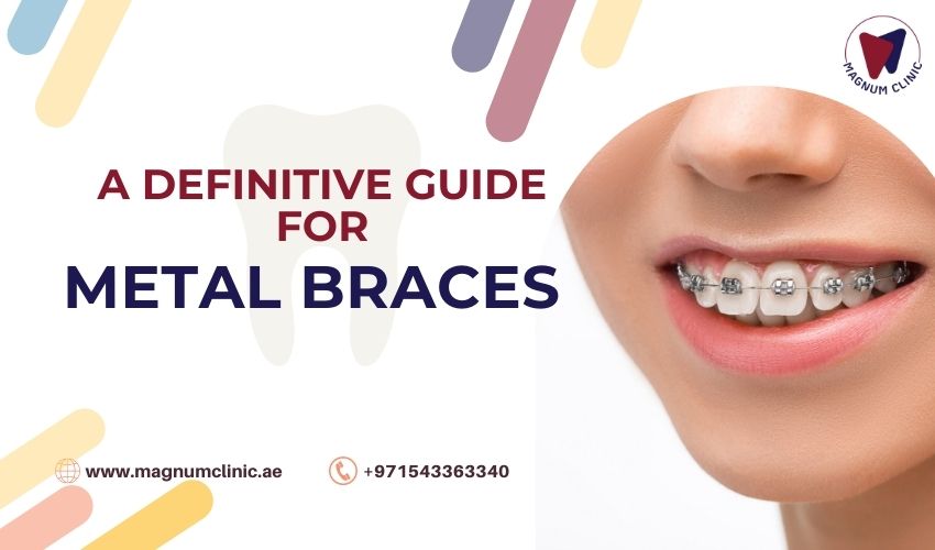 Metal Braces For Your Teeth