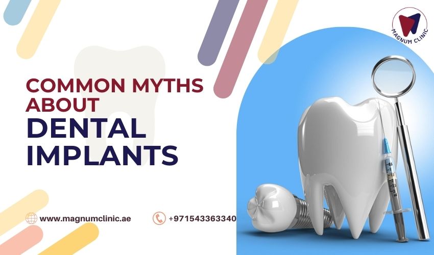 Myths About Dental Implants