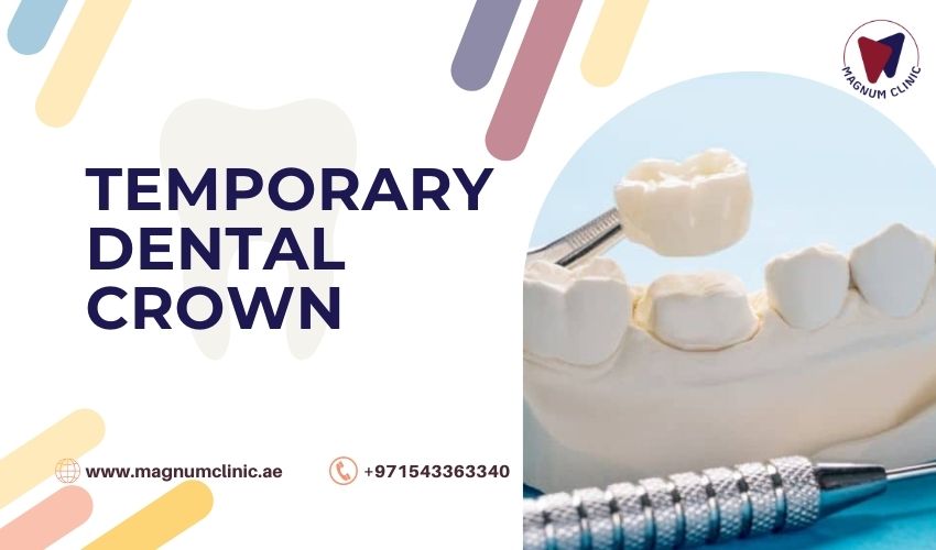 Temporary Dental Crowns
