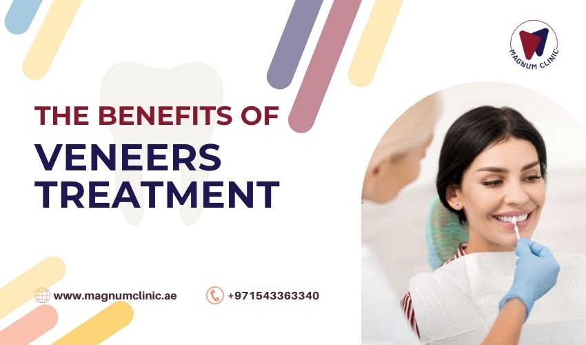Benefits of Veneers Treatment