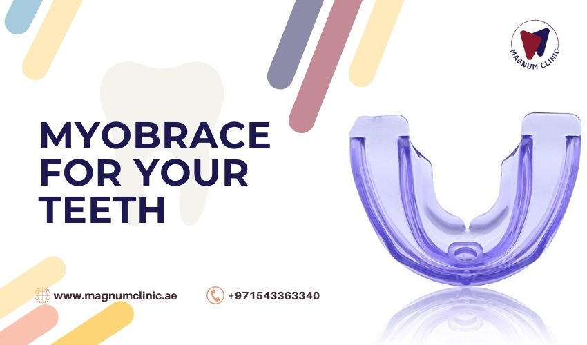 Myobrace For Your Teeth