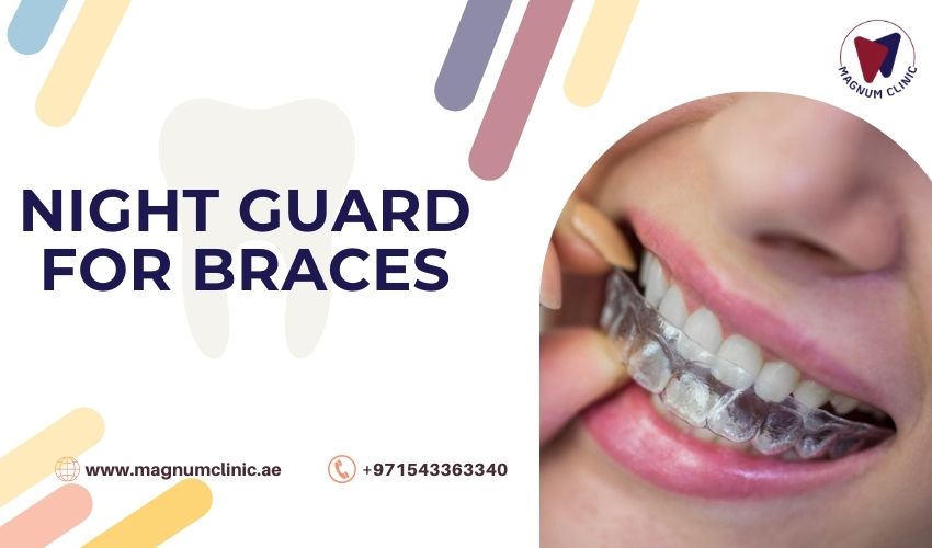 Night Guard for Braces