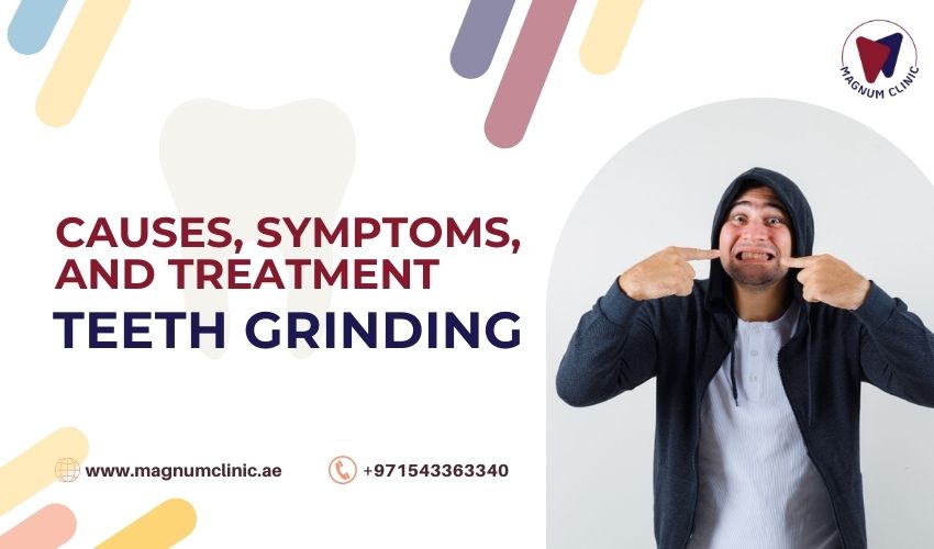 Teeth Grinding (Bruxism)